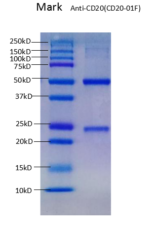 Anti-CD20-01F SDS PAGE